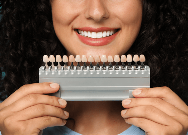 Blanqueamiento Dental Profesional
