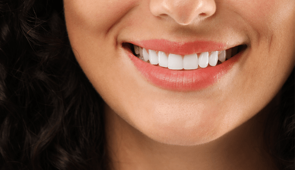 blanqueamiento dental