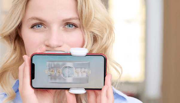 dental-monitoring