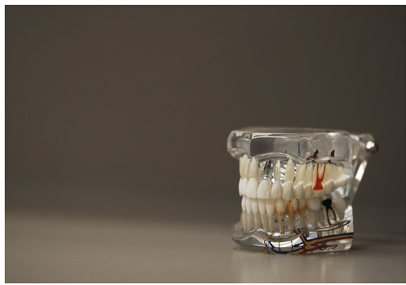 endodoncia denia