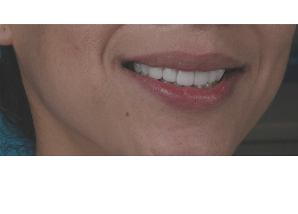 estetica