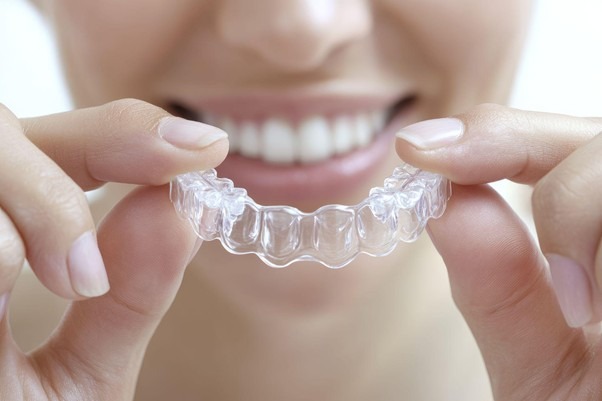 invisalign-vida