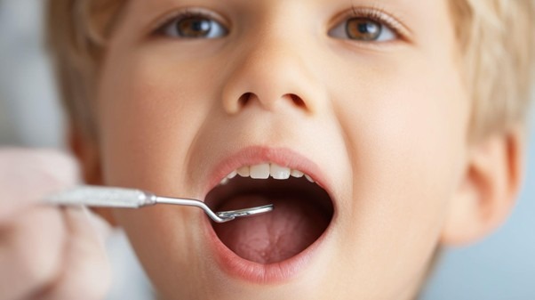 caries-ninos