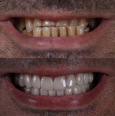 Rehabilitacion-funcional-y-estetica.jpg
